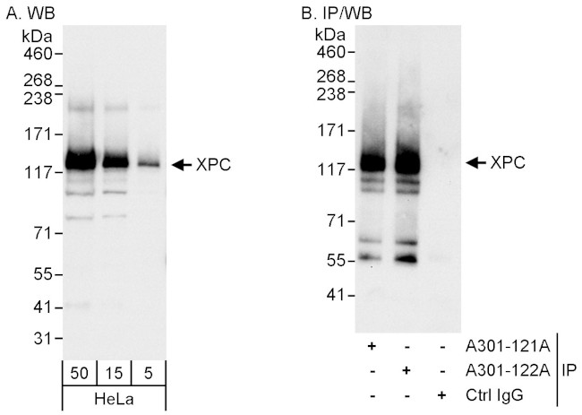 XPC Antibody in Western Blot (WB)