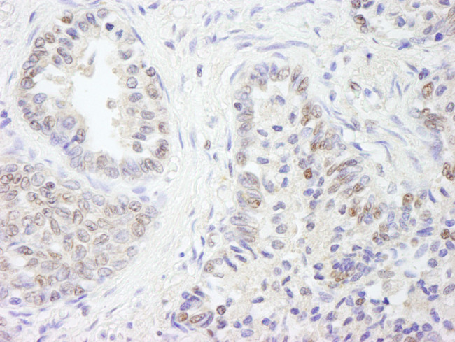 UBE1 Antibody in Immunohistochemistry (Paraffin) (IHC (P))