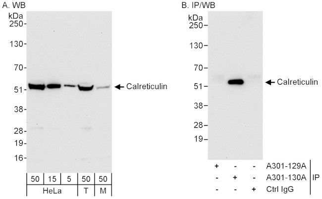 Calreticulin Antibody in Western Blot (WB)