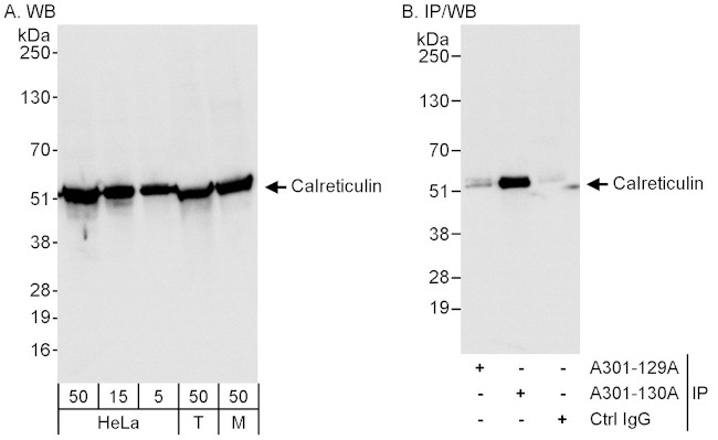 Calreticulin Antibody in Western Blot (WB)