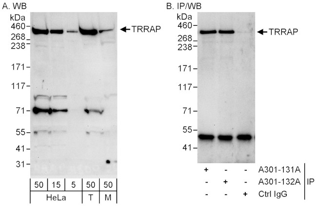 TRRAP Antibody in Western Blot (WB)