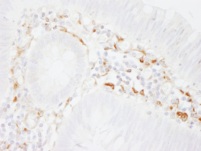 Filamin A Antibody in Immunohistochemistry (Paraffin) (IHC (P))