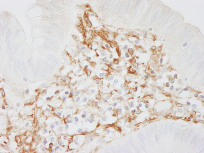 Filamin A Antibody in Immunohistochemistry (Paraffin) (IHC (P))