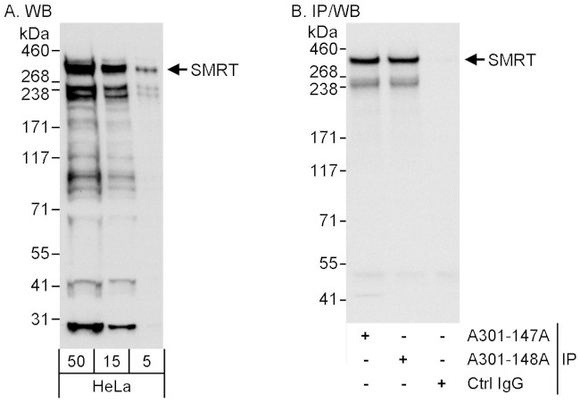 SMRT Antibody in Western Blot (WB)