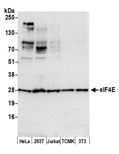 eIF4E Antibody in Western Blot (WB)