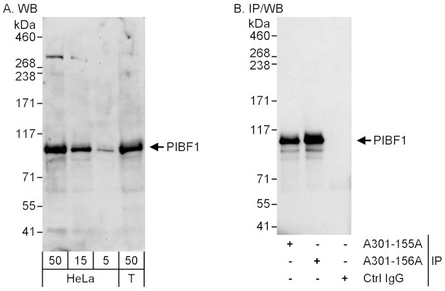 PIBF Antibody in Western Blot (WB)