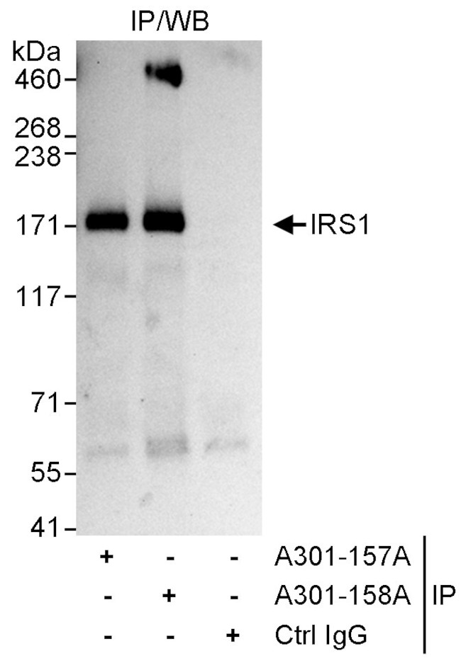 IRS1 Antibody in Immunoprecipitation (IP)