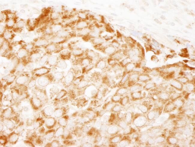 IRS1 Antibody in Immunohistochemistry (Paraffin) (IHC (P))