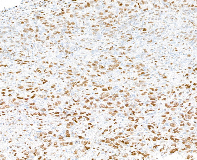 PML Antibody in Immunohistochemistry (Paraffin) (IHC (P))