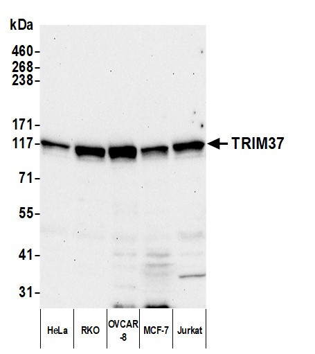 TRIM37 Antibody in Western Blot (WB)