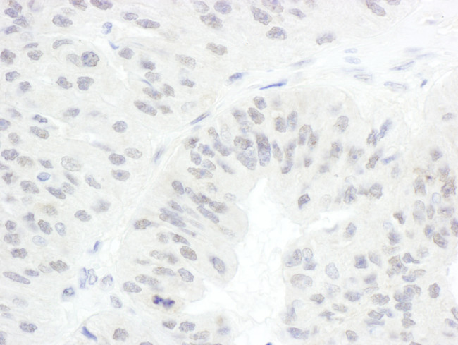 CDC20 Antibody in Immunohistochemistry (Paraffin) (IHC (P))