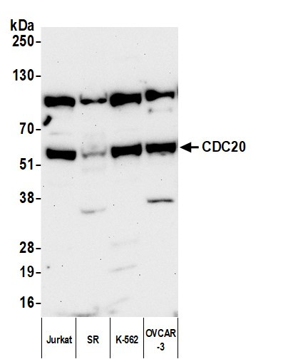 CDC20 Antibody in Western Blot (WB)