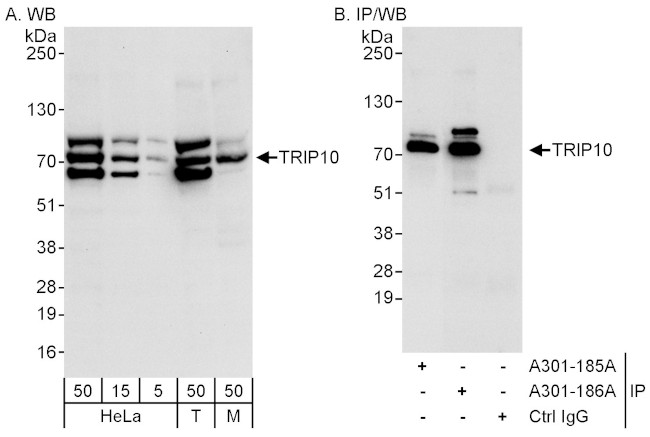 TRIP10/CIP4 Antibody in Western Blot (WB)