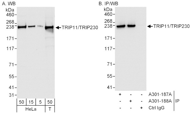 TRIP11/TRIP230 Antibody in Western Blot (WB)