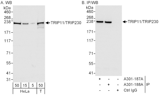 TRIP11/TRIP230 Antibody in Western Blot (WB)