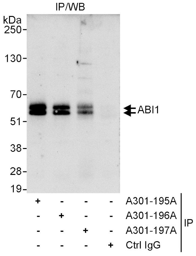 ABI1 Antibody in Immunoprecipitation (IP)