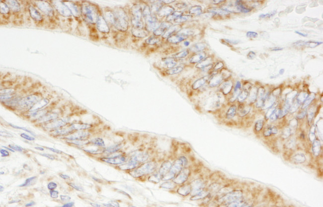 TRIM3/BERP Antibody in Immunohistochemistry (Paraffin) (IHC (P))