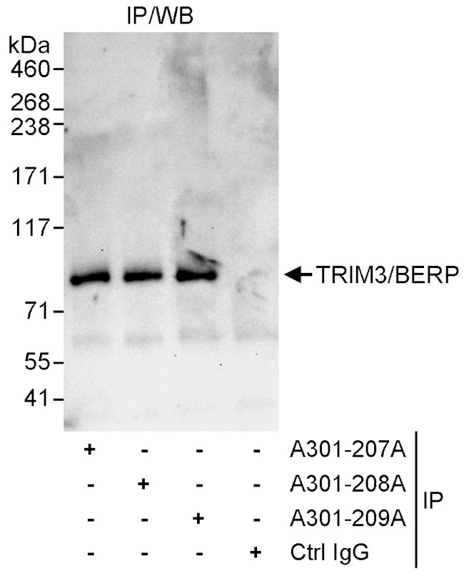 TRIM3/BERP Antibody in Immunoprecipitation (IP)