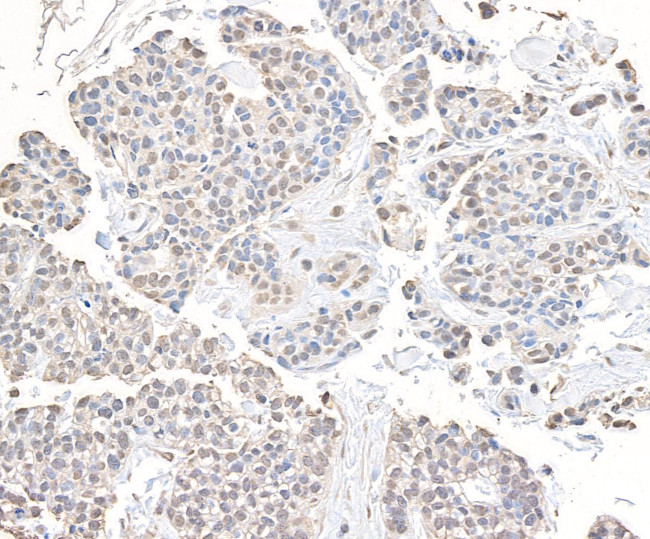 CHD8 Antibody in Immunohistochemistry (Paraffin) (IHC (P))