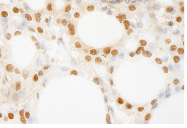 BRF1 Antibody in Immunohistochemistry (Paraffin) (IHC (P))