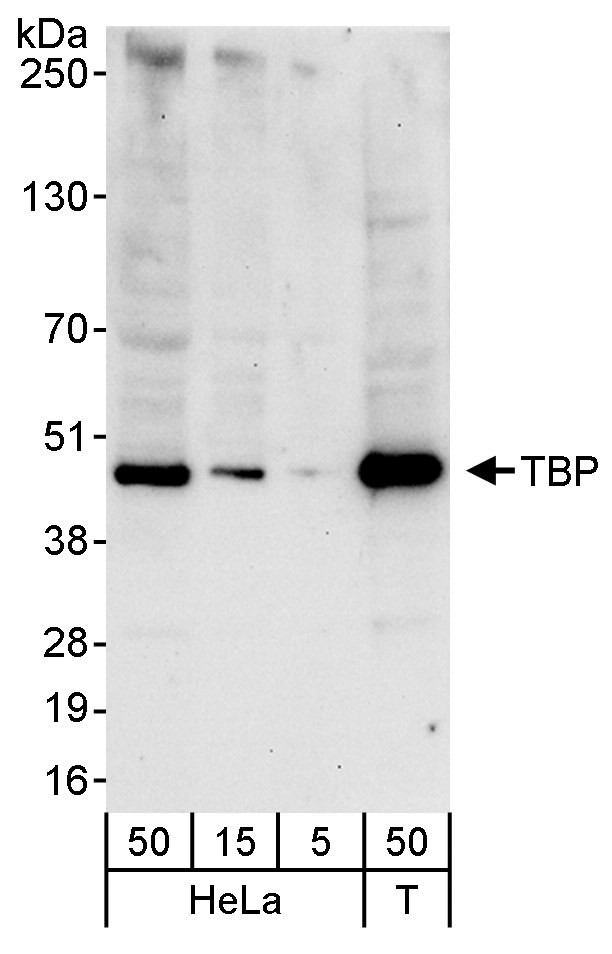 TBP Antibody in Western Blot (WB)