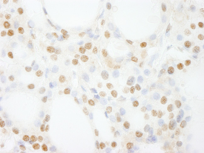 GTF3C4/TFIIIC90 Antibody in Immunohistochemistry (Paraffin) (IHC (P))