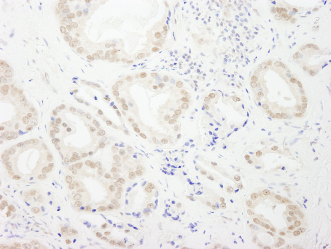 GTF3C4/TFIIIC90 Antibody in Immunohistochemistry (Paraffin) (IHC (P))