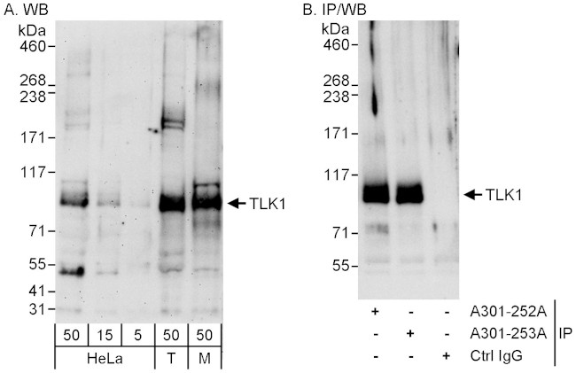 TLK1 Antibody in Western Blot (WB)