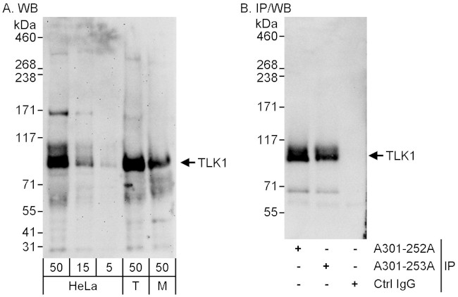 TLK1 Antibody in Western Blot (WB)