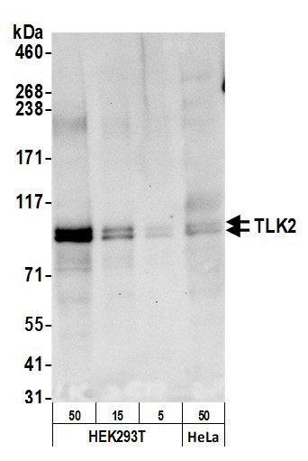 TLK2 Antibody in Western Blot (WB)