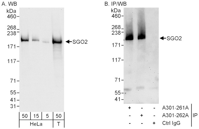 SGO2 Antibody in Western Blot (WB)