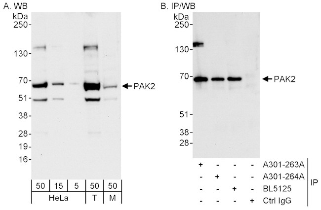 PAK2 Antibody in Western Blot (WB)