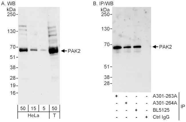 PAK2 Antibody in Western Blot (WB)