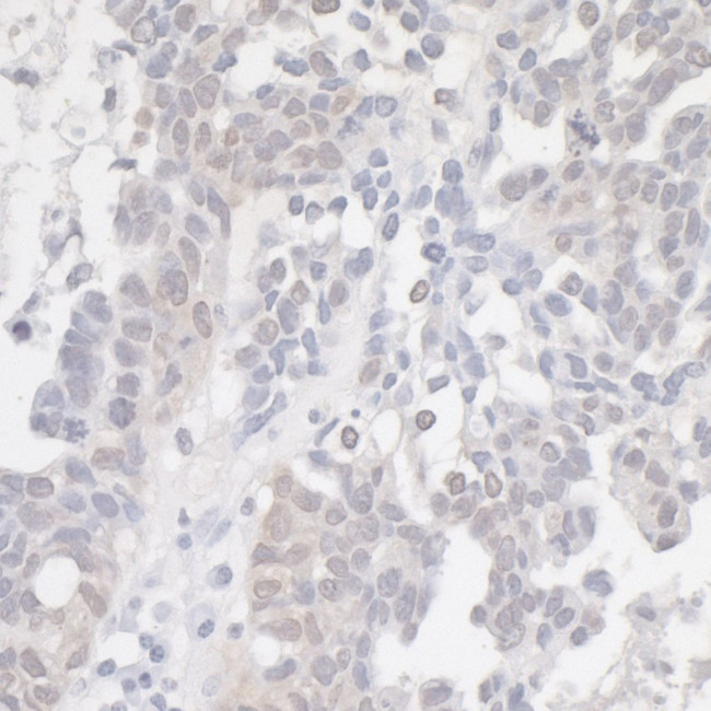 p16INK4a Antibody in Immunohistochemistry (Paraffin) (IHC (P))