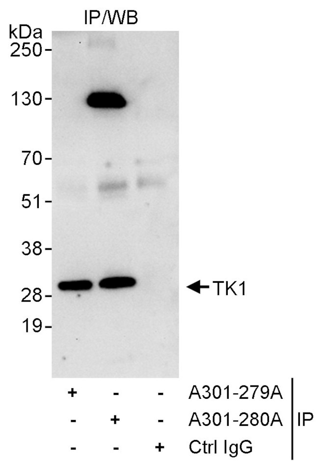 TK1 Antibody in Immunoprecipitation (IP)