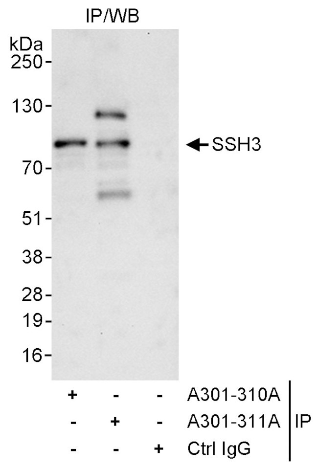 SSH3 Antibody in Immunoprecipitation (IP)