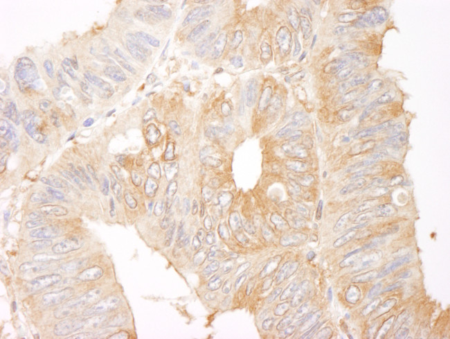 Coronin 2 Antibody in Immunohistochemistry (Paraffin) (IHC (P))