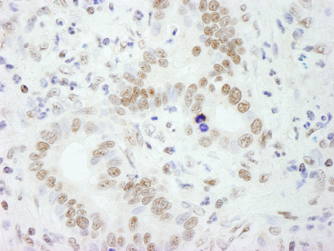 PSF/SFPQ Antibody in Immunohistochemistry (Paraffin) (IHC (P))