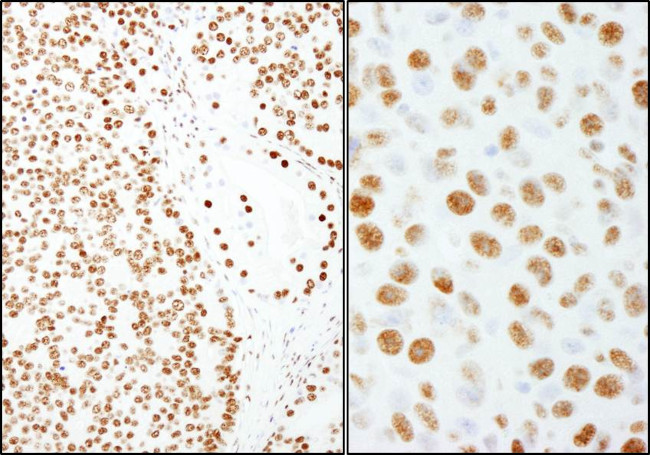 PSF/SFPQ Antibody in Immunohistochemistry (Paraffin) (IHC (P))