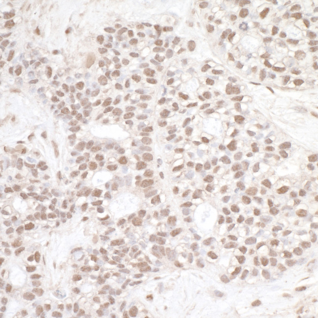 ERCC3 Antibody in Immunohistochemistry (Paraffin) (IHC (P))