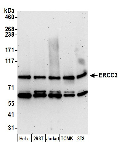 ERCC3 Antibody in Western Blot (WB)