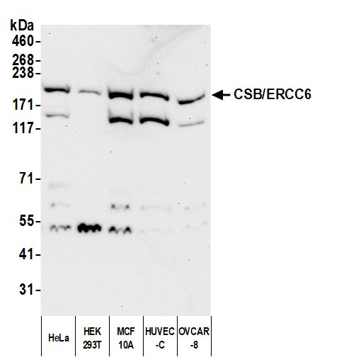 CSB/ERCC6 Antibody in Western Blot (WB)