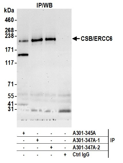 CSB/ERCC6 Antibody in Immunoprecipitation (IP)