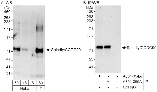 SPINDLY/CCDC99 Antibody in Western Blot (WB)