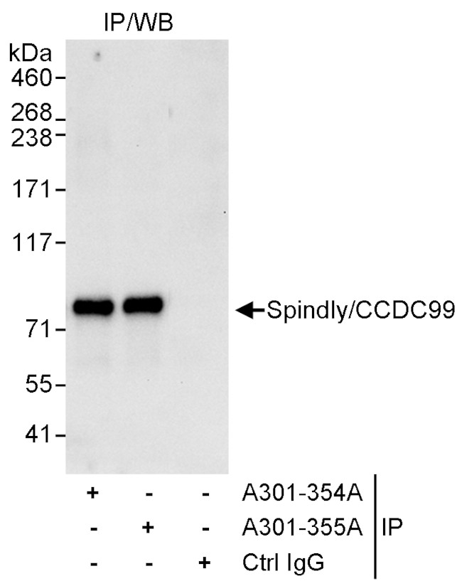 SPINDLY/CCDC99 Antibody in Immunoprecipitation (IP)