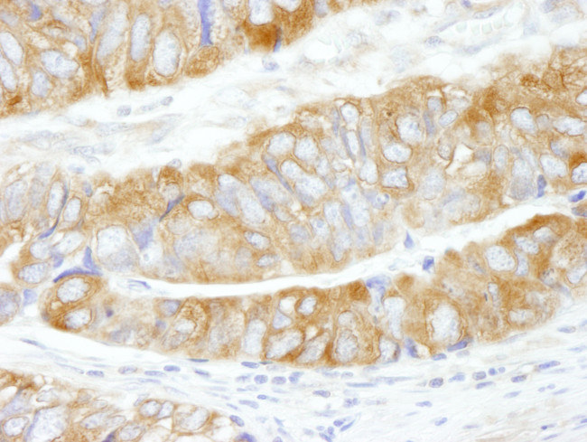 CAD Antibody in Immunohistochemistry (Paraffin) (IHC (P))