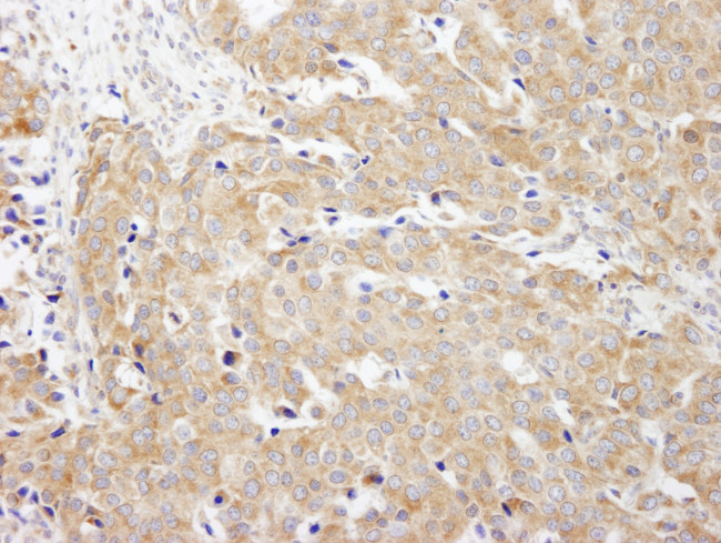 CAD Antibody in Immunohistochemistry (Paraffin) (IHC (P))