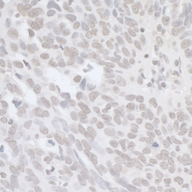 BRCA1 Antibody in Immunohistochemistry (Paraffin) (IHC (P))