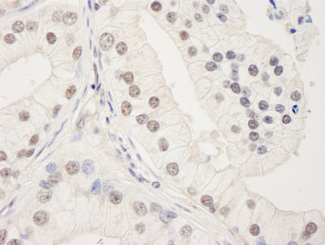 UACA Antibody in Immunohistochemistry (Paraffin) (IHC (P))