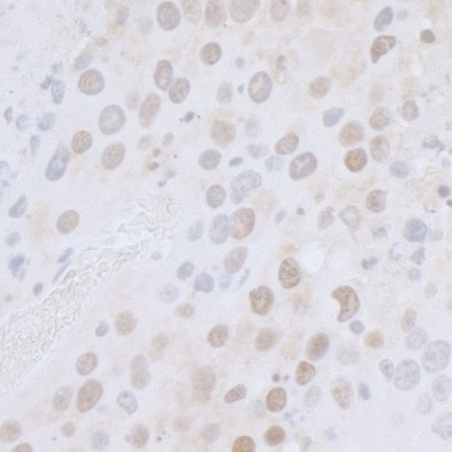 CTR9 Antibody in Immunohistochemistry (Paraffin) (IHC (P))